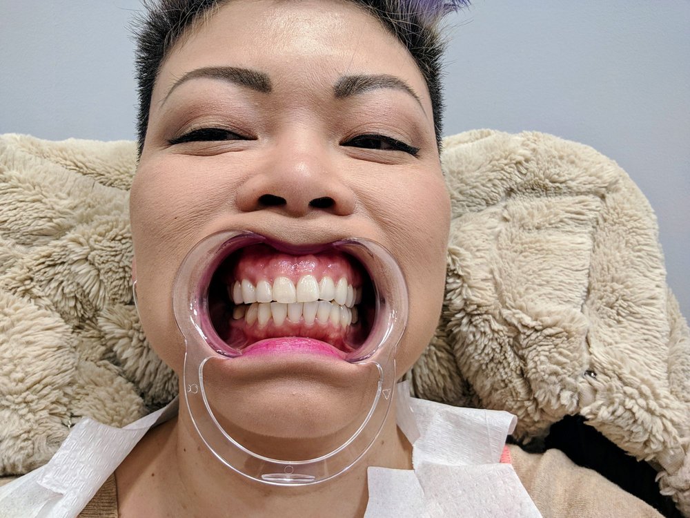 SMILING BRIGHT Updated July 2024 32 Photos & 194 Reviews 3168 N