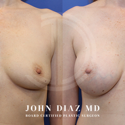 John Diaz, MD