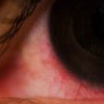 TJ Brows & Lashes - Cheap glue irritated my eyes the next day - Eyelash Service Near Me - San Jose, California