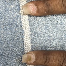 Nail Envy - Update: Lack of proper amount of acrylic powder resulted in Fungus.