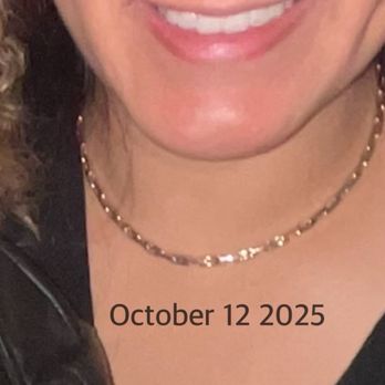 Vladimir Grigoryants, MD - Oct 12 2025 1 year 6 months post of - Cosmetic Surgeons Near Me - Glendale, California Vladimir Grigoryants, MD - Oct 12 2025 1 year 6 months post of - Cosmetic Surgeons Near Me - Glendale, California