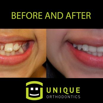 Unique Orthodontics - Orthodontists Near Me - Clovis, California Unique Orthodontics - Orthodontists Near Me - Clovis, California