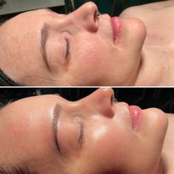 Divine Design Beauty Bar - Before and after of a 60 minutes facial with nano hydration infusion. Look at that glow! #thatspaglow
