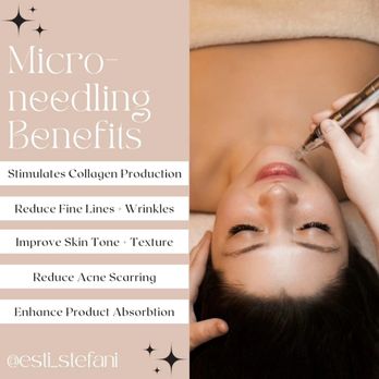 Lashes + Skincare By Stefani - Microneedling benefits: stimulates collagen production, reduces fine lines, improves skin texture, reduces scarring, enhances product abs... - Skin Care Near Me - Austin, Texas Lashes + Skincare By Stefani - Microneedling benefits: stimulates collagen production, reduces fine lines, improves skin texture, reduces scarring, enhances product abs... - Skin Care Near Me - Austin, Texas