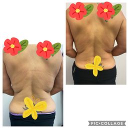 The bottom is the before picture. You can see my waist look inflamated & bloated. Top right picture is the after. Look at my waist now! The bottom is the before picture. You can see my waist look inflamated & bloated. Top right picture is the after. Look at my waist now!