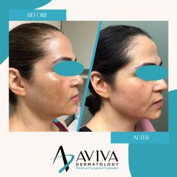 Aviva Dermatology