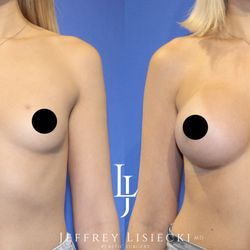 Jeffrey Lisiecki,MD