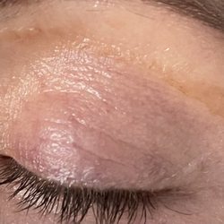 Ceci Nail&Spa - Few days after and still healing.