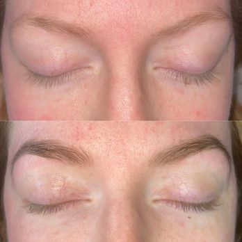 Ecstatic Skin - Skin Care Near Me Ecstatic Skin - Skin Care Near Me
