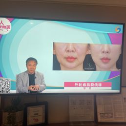 Dr. Yu talking about thread lifting