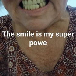 Quincy Dental - Mal trabajo hecho por la dra Annemary thomas protesis fija de coronas demasiado grande