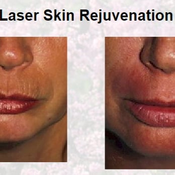 Todd E. Perkins, MD - Laser Skin Rejuvenation Washington, DC - Dermatologists Near Me - Washington, DC, District of Columbia Todd E. Perkins, MD - Laser Skin Rejuvenation Washington, DC - Dermatologists Near Me - Washington, DC, District of Columbia