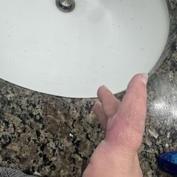Health First Palm Bay Hospital - After 2nd ER visit & third draining/soaking honestly I was scared to even look at it.