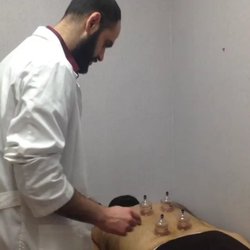 Bonafide Acupuncture & Herbs - Hijama