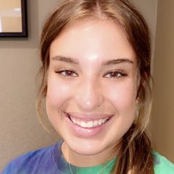 James S. Minutello, DDS, Tricia D. Bato - DDS & Associates - Before