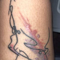 Kingpin Tattoos - bad scarring after a month