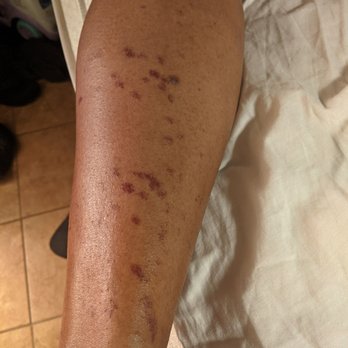 Azul Medspa - Laser Hair Removal Near Me - El Paso, Texas