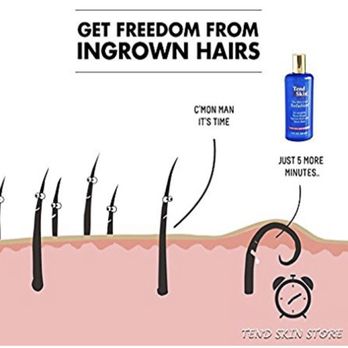 Tend Skin Lotion For Ingrown Hair Yelp