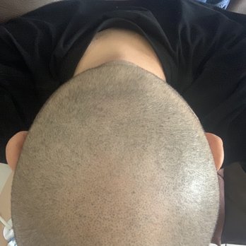 Therapeutic Cuts - Crown all filled in !! - Barbers Near Me - Rego Park, New York Therapeutic Cuts - Crown all filled in !! - Barbers Near Me - Rego Park, New York