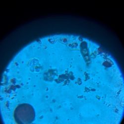 Lake Allergy, Asthma & Immunology - There is grass pollen on the bottom left and alternaria (mold spore) on the right