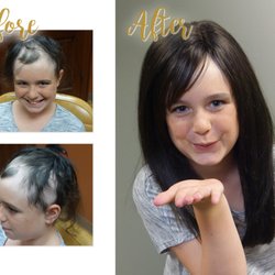 Christoffels Hair Restoration - Custom hair system for alopecia, an autoimmune disease (also known as pattern baldness) in which hair is lost.