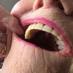 About Face Dental Medi-Spa - Patient's teeth