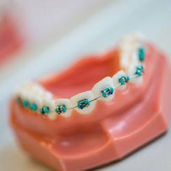 Aubin Orthodontics - Aubin Orthodontics