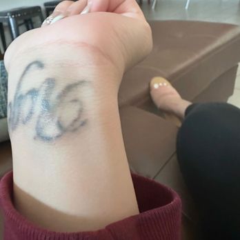 Bonsai Laser Tattoo Removal - Tattoo Removal Near Me - Rowlett, Texas
