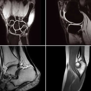 Caspian Diagnostic Imaging - Clear and Sharp Images give Acute Information to Doctors to Exactly Determine the Problem. - Diagnostic Imaging Near Me - Houston, Texas Caspian Diagnostic Imaging - Clear and Sharp Images give Acute Information to Doctors to Exactly Determine the Problem. - Diagnostic Imaging Near Me - Houston, Texas