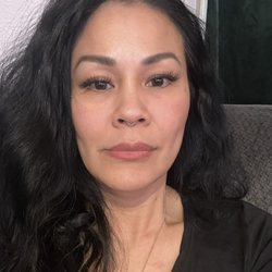 Bednar Cosmetic Surgery: Dr. Edward J. Bednar, MD - Four years post picture update