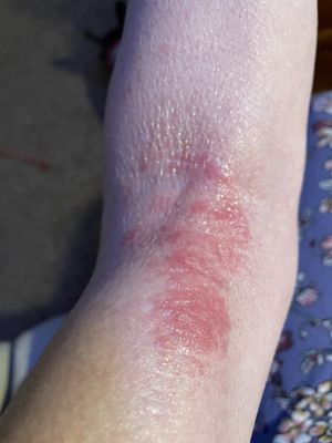 Integrated Dermatology of Groton