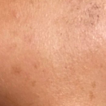 Laser Tysons Paramedical Spa - Laser Hair Removal Near Me - Vienna, Virginia Laser Tysons Paramedical Spa - Laser Hair Removal Near Me - Vienna, Virginia