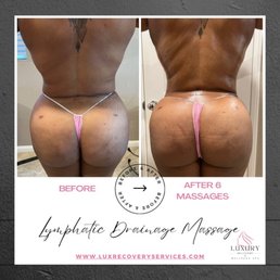 This is my BEFORE and AFTER following 6 sessions. This is my BEFORE and AFTER following 6 sessions.