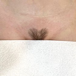 The Skyn Suite - Brazilian Sugaring