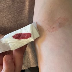 Quest Diagnostics - Horrible blood draw