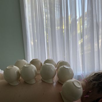 Heidi Keating, DACM, L.AC - Cupping - Massage Therapy Near Me - Ponderay, Idaho Heidi Keating, DACM, L.AC - Cupping - Massage Therapy Near Me - Ponderay, Idaho