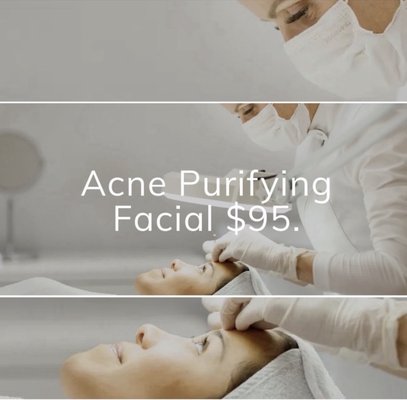 Facial - A deep cleansing facial that targets breakouts. Call and book today! Facial - A deep cleansing facial that targets breakouts. Call and book today!