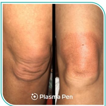 Cherry Blossom MedSpa - Skin Care Near Me - Chandler, Arizona Cherry Blossom MedSpa - Skin Care Near Me - Chandler, Arizona
