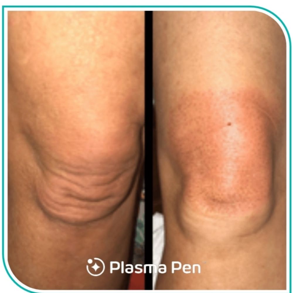 Cherry Blossom MedSpa Logo