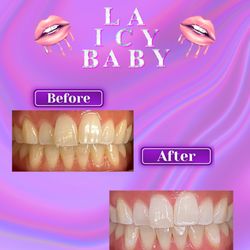 La Icy Baby
