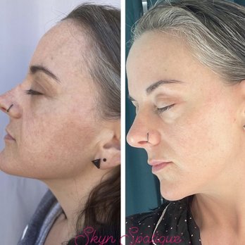 SKYN Spatique Esthetics - Skin Care Near Me SKYN Spatique Esthetics - Skin Care Near Me