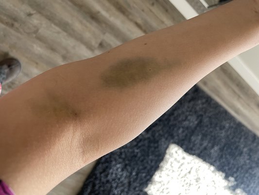 MID VALLEY SURGERY CENTER - Updated September 2024 - 24 Reviews - 4682 Ontario Mills Pkwy