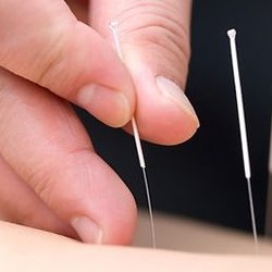 West London Osteopathy, Acupuncture Clinic