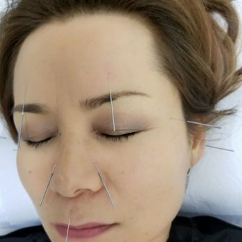 Choi's Acupuncture & Herbal Clinic - After this treatment I could breath easily. Thank you Dr. Choi! - Acupuncture Near Me - Honolulu, Hawaii Choi's Acupuncture & Herbal Clinic - After this treatment I could breath easily. Thank you Dr. Choi! - Acupuncture Near Me - Honolulu, Hawaii