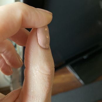 COCO Nail Bar - The image depicts a close-up of a person's thumb and index finger, focusing on the thumbnail which has a small tear or cut. The skin appears smooth with natural lighting, and the background is dark and out of focus, providing no additional context. - Nail Salons Near Me - Algonquin, Illinois