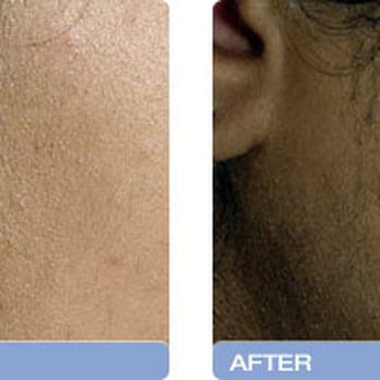 Pretty Faces Atlanta - Medical Spas Near Me - Atlanta, Georgia Pretty Faces Atlanta - Medical Spas Near Me - Atlanta, Georgia