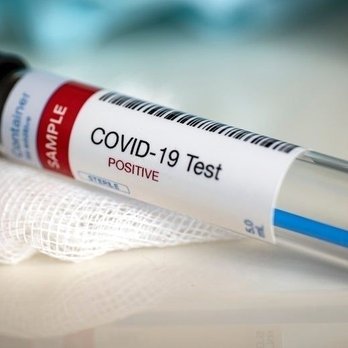 David’s Pharmacy - PCR,Antigen and Antibody Covid test available - Pharmacy Near Me - Charlotte, North Carolina David’s Pharmacy - PCR,Antigen and Antibody Covid test available - Pharmacy Near Me - Charlotte, North Carolina