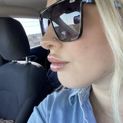 Alon Aesthetics Plastic Surgery - Lip filler