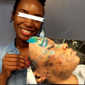 diverse skin solutions