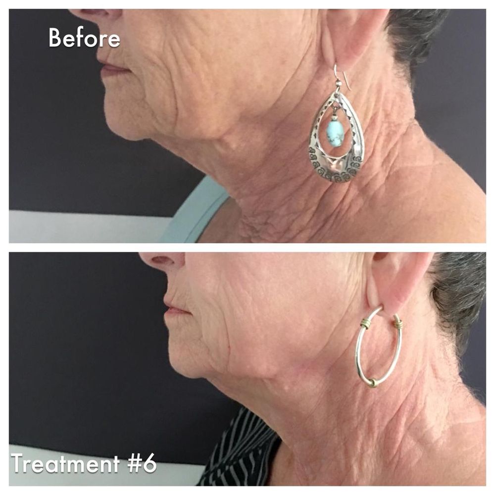 RONIT PEER SKIN CARE - 56 Photos - 125 S Main St, New City, NY - Yelp